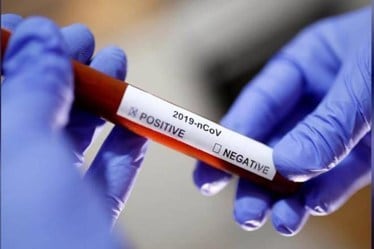 The source of the infection of 663 patients was unknown, the Minister said. "At least 64 health workers turned COVID-19 positive on Wednesday.
