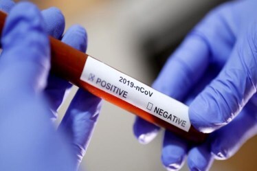 coronavirus testing, coronavirus testing in Delhi, coronavirus testing near me, coronavirus testing India, coronavirus testing kit, coronavirus testing labs, coronavirus testing machine, coronavirus testing procedure, coronavirus testing center, covid 19 testing near me, covid 19 testing Delhi, covid 19 testing kit, covid 19 testing labs near me