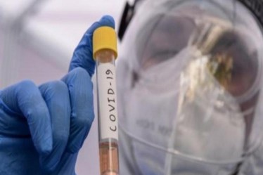 Tamil Nadu Agriculture Minister, Covid 19, Coronavirus, R Doraikkannu, COVID pneumonia, TN Minister health latest news