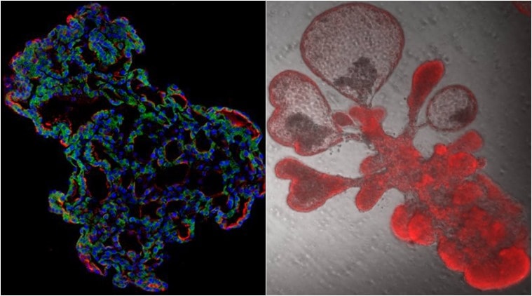 In the experiments, the researchers developed a model using mini-lungs, also known as lung organoids. Image: IE