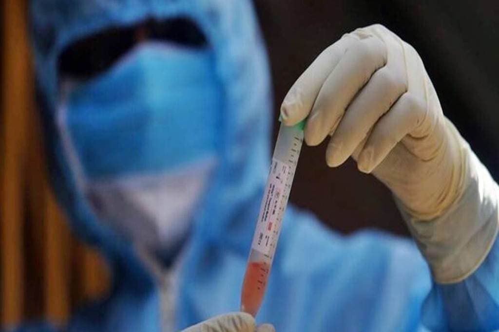 The COVID-19 case fatality rate has further declined to 1.55 per cent. (Representational image: IE)