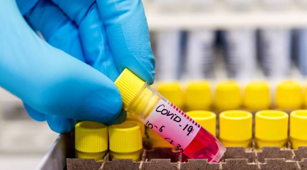 ''A safe and durable vaccine is urgently needed to tackle the COVID-19 pandemic that has infected millions of people and caused over 620,000 deaths globally," Vardarajan told PTI. (Photo source: Reuters)