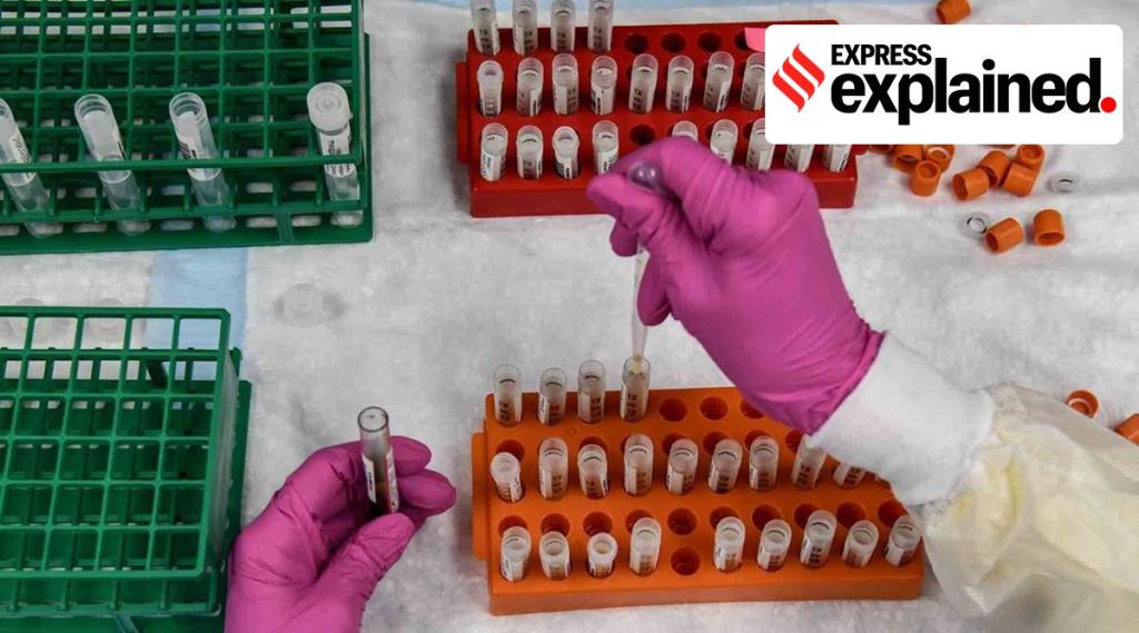 A volunteer receives an injection at the Chris Hani Baragwanath hospital in Soweto, Johannesburg, as part of Africa's first participation in a COVID-19 vaccine trial developed at the University of Oxford in Britain in conjunction with the pharmaceutical company AstraZeneca. (AP photo/FILE)