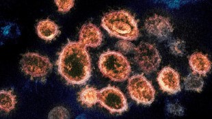 covid 19 coronavirus