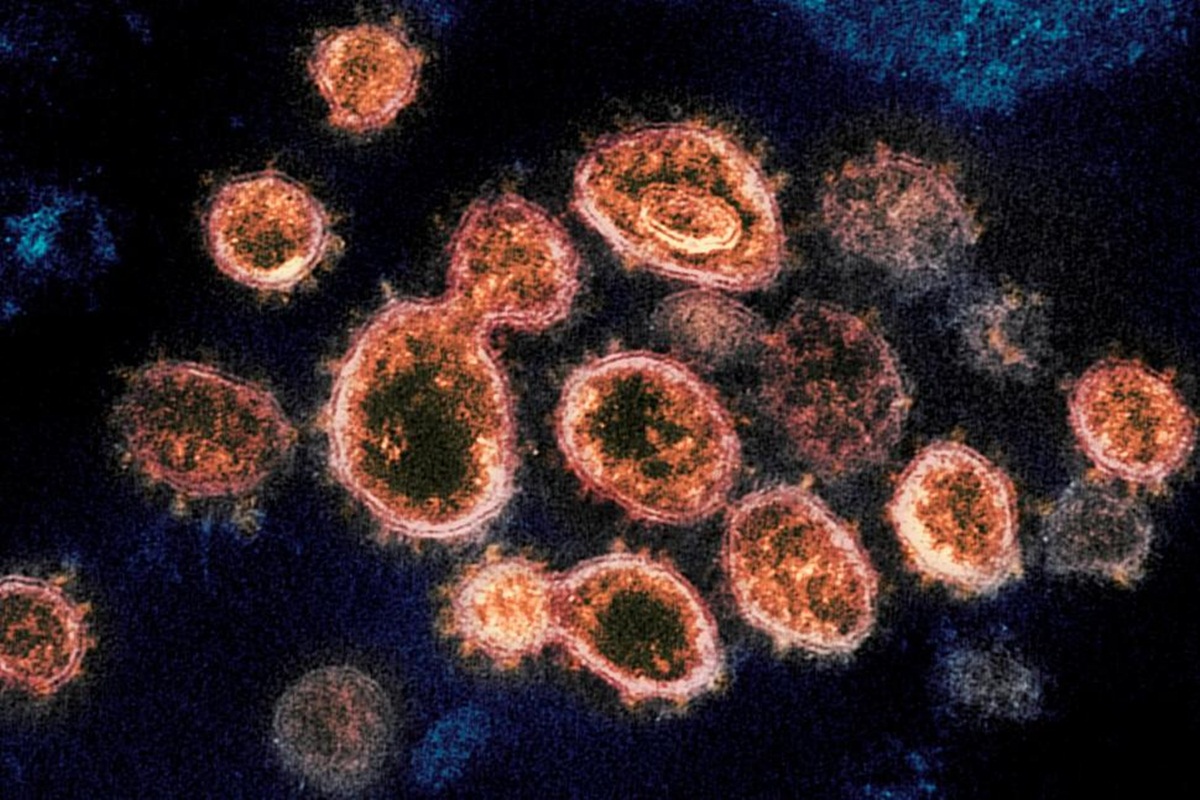 covid 19 coronavirus covid 19 coronavirus