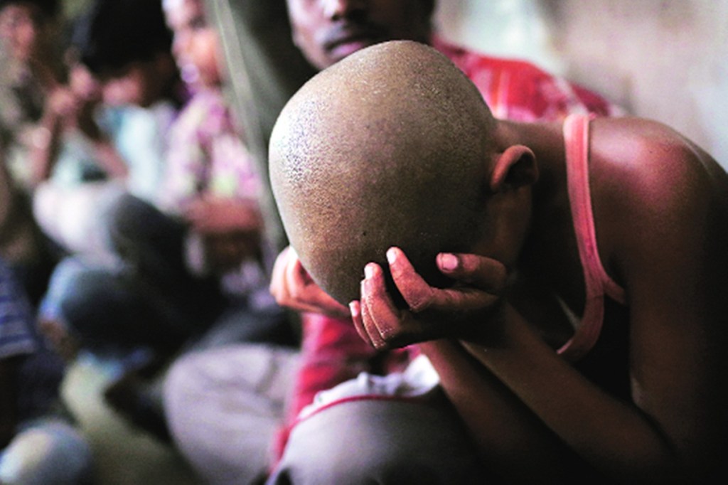 Malnourished children and adolescents are at higher risk for impaired growth. (File photo: AP) Malnourished children and adolescents are at higher risk for impaired growth. (File photo: AP)