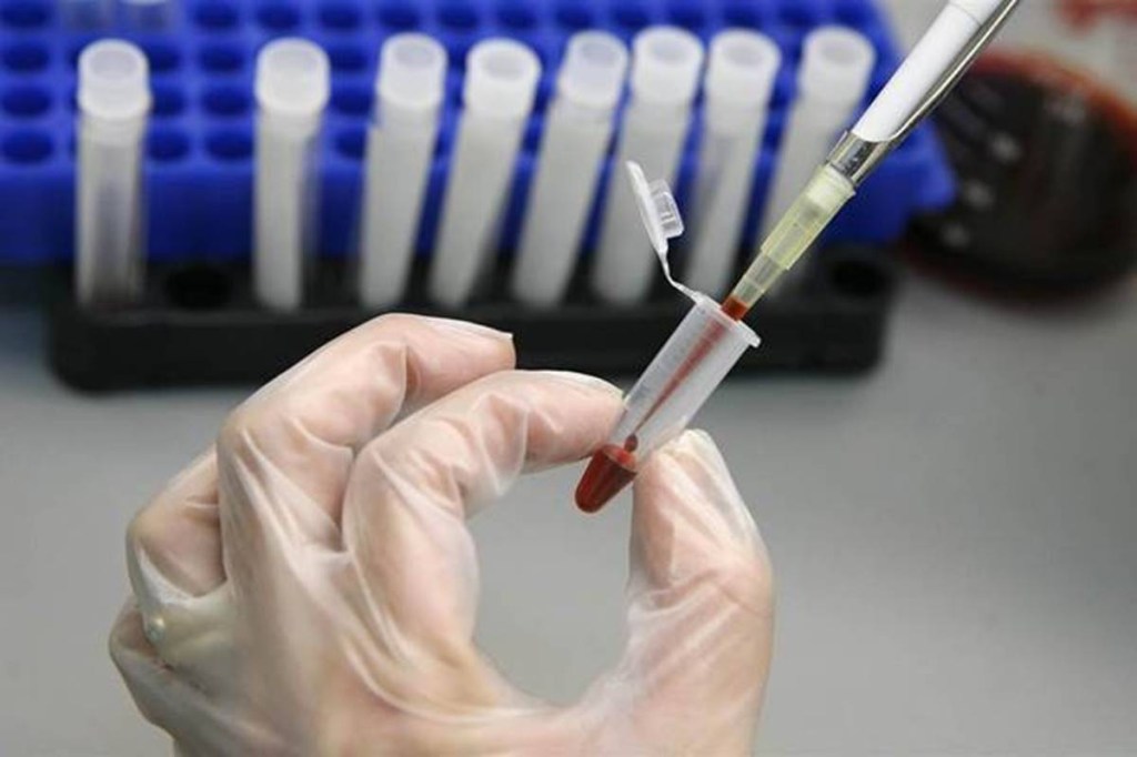 The novel Coronavirus is also believed to have originated in one of the wildlife markets in the Wuhan city of China.