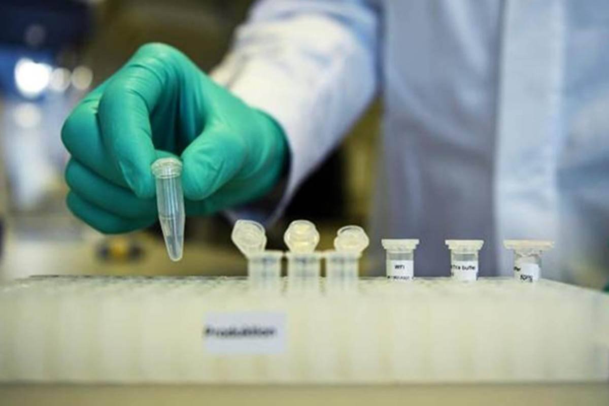 Krsnaa Diagnostics, COVID-19, IPO Krsnaa Diagnostics, COVID-19, IPO