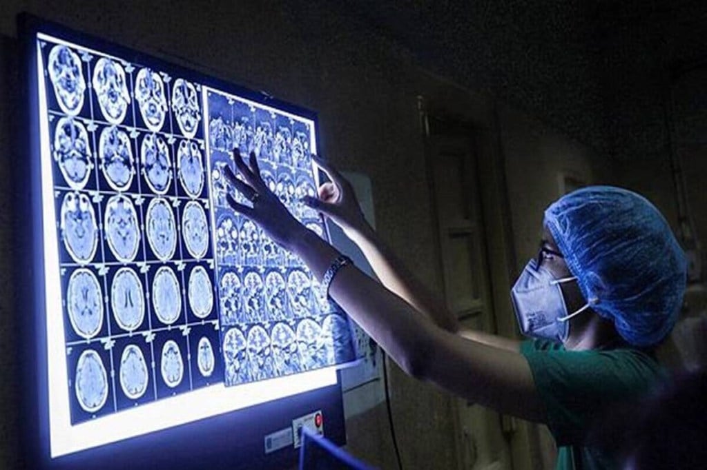 Black fungus, mucromyosis, symptoms of mucromyosis, death rate of mucromyosis, diabetes leading to mucromyosis,, PGIMER Chandiger study on mucromyosis, steroids leading to mucromyosis,