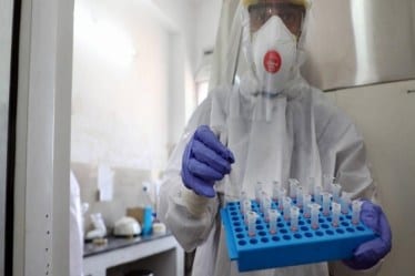 covid research, covid virus on hospitaal surface, coronavirus on patinets room, SARS-CoV-2, coronavirus study, US based study on coronavirus