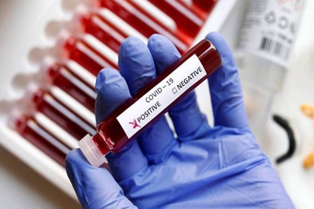 maharashtra, RT-PCR test