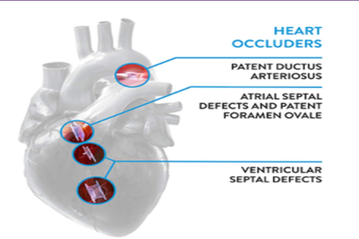 Congenital Heart Disease, CHD, Abbott, paediatric cardiac care services, patent ductus arteriosus,