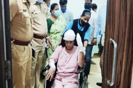 Kalpita Pimple Kalpita Pimple