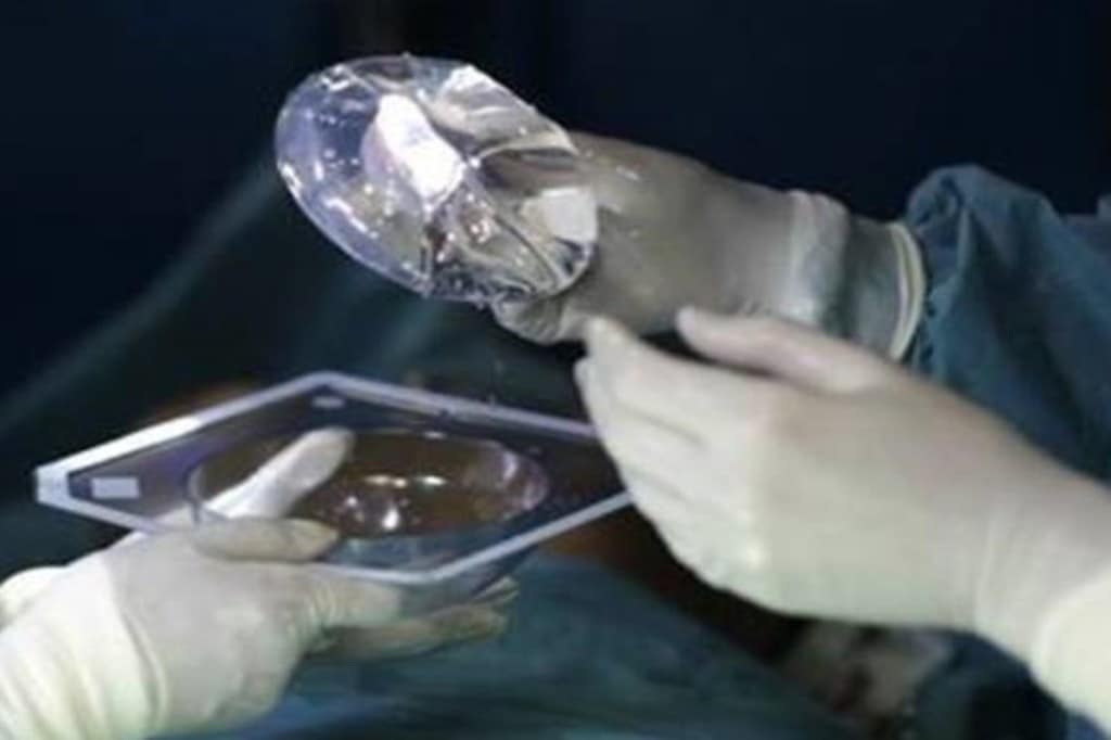 price monitoring, regulating prices, unethical profiteering, affordable, quality healthcare, NPPA, medical devices associations, medical device, pricing data, Orthopaedic Knee Implants, Orthopaedic Knee Replacement System