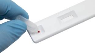 Covid-19, Neutralizing Antibody Test, Coronavirus, Pfizer, Moderna, Covid-19 vaccine, Covishield, SARS-CoV-2 virus, NAb, DCGI