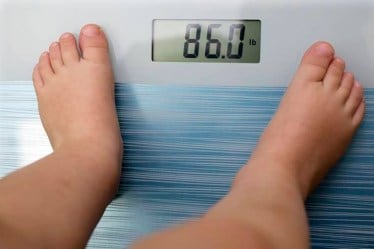 childhood obesity