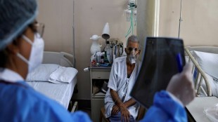 Covid X-Ray (Reuters)