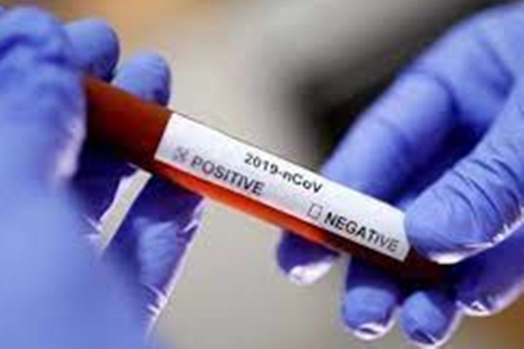 Covid-19, In-vitro diagnostics market, chronic diseases, point-of-care, diagnostics, personalized medicine, companion diagnostics, lab-on-a-chip, wearable devices, POC testing, Atmanirbhar Bharat Abhiyaan