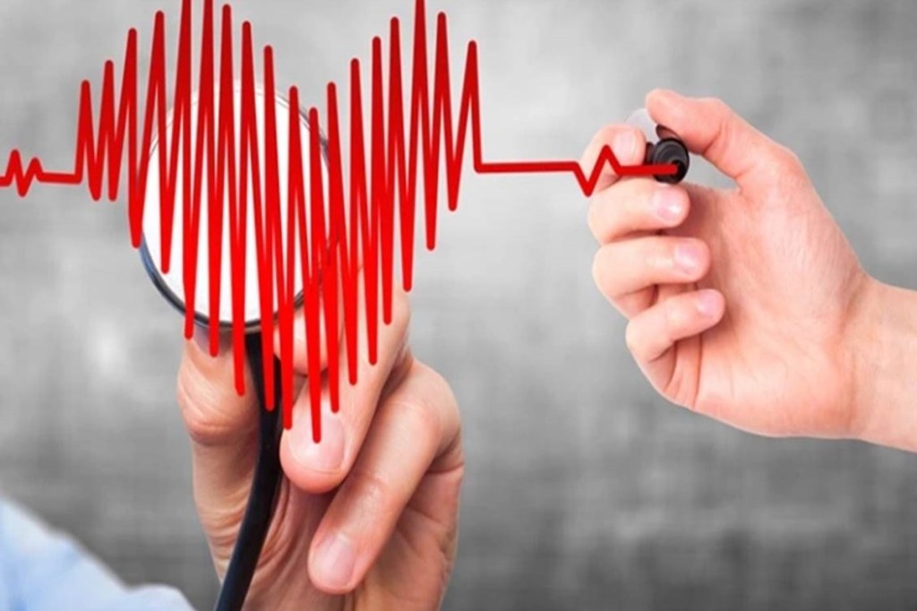 Coronavirus, stroke, VTE, shock, heart failure, myocarditis and arrhythmias, cardiac mortality, cardio vascular disease, CVD, Covid-19, FEhealthcare.com Cardiology Summit 2021