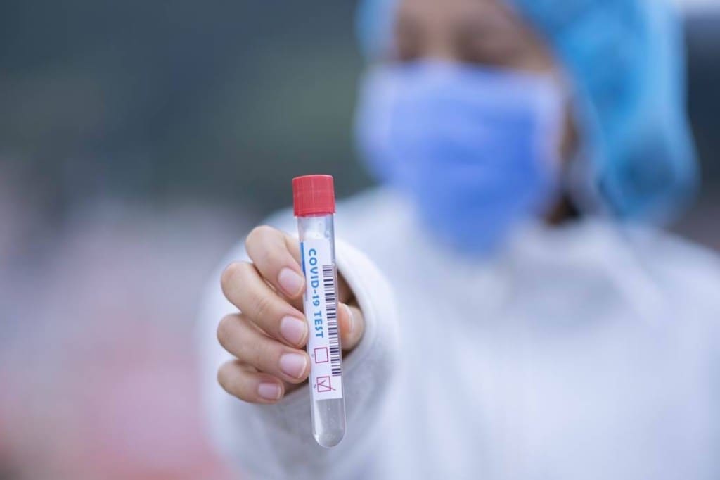 Polymerase Chain Reaction