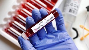 Last year in November, the company had launched its COVID testing kit, 'TataMD CHECK', developed in partnership with CSIR-IGIB. (Representative image)