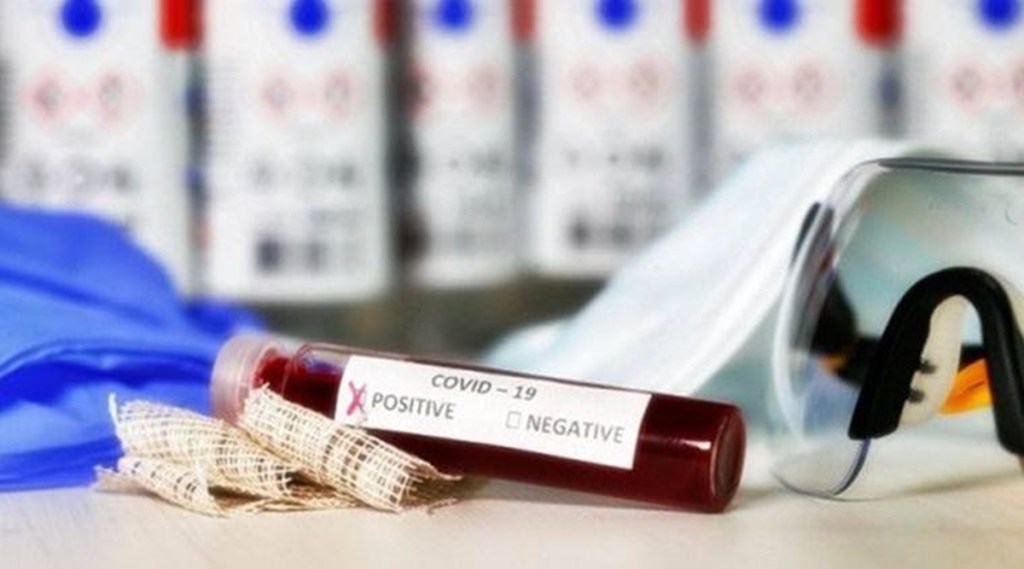The state's positivity rate jumped to 5.47 per cent, from 2.84 per cent on Wednesday. (File)
