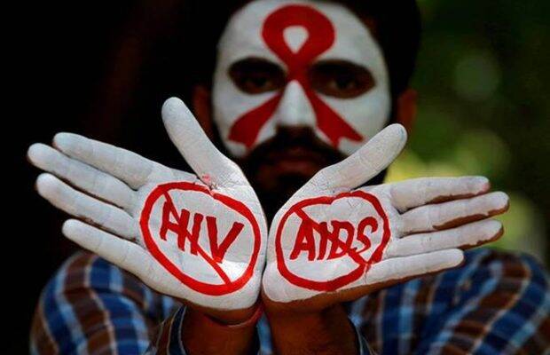 HIV AIDS