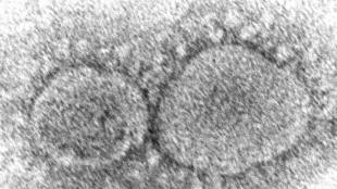 covid 19 virus