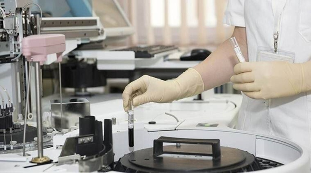 The state had recorded 4,512 Covid-19 cases on Saturday, with the metropolis alone reporting 2,398 of them. (File)