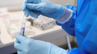 RT-PCR-test in west bengal