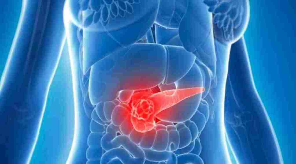The experiment showed that the ketogenic diet changes pancreatic cancer metabolism and their response to chemotherapy.
