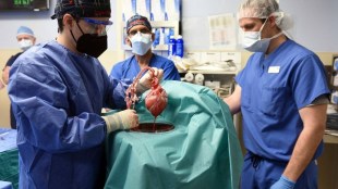 Pig heart, pig heart transplantation, human heart, transplant surgery, health news, medical news,