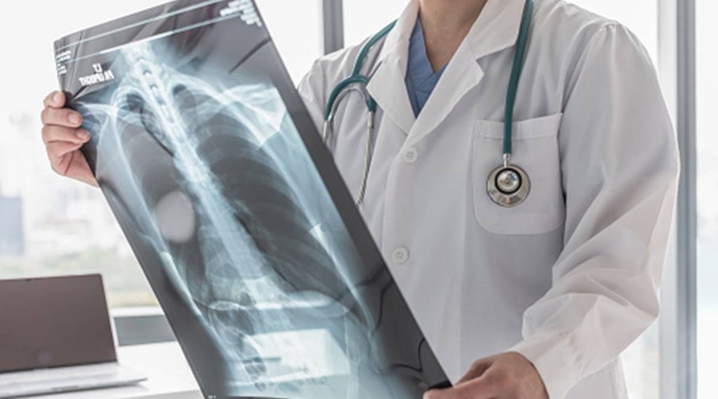 Even after successful therapy, survivors have a higher risk of recurrent infection and even death, the study has found. (IE) Even after successful therapy, survivors have a higher risk of recurrent infection and even death, the study has found. (IE)