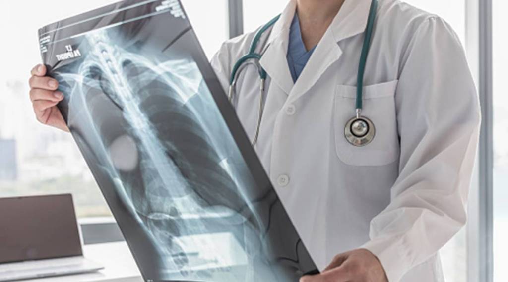 Even after successful therapy, survivors have a higher risk of recurrent infection and even death, the study has found. (IE)