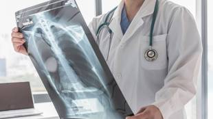 Even after successful therapy, survivors have a higher risk of recurrent infection and even death, the study has found. (IE)