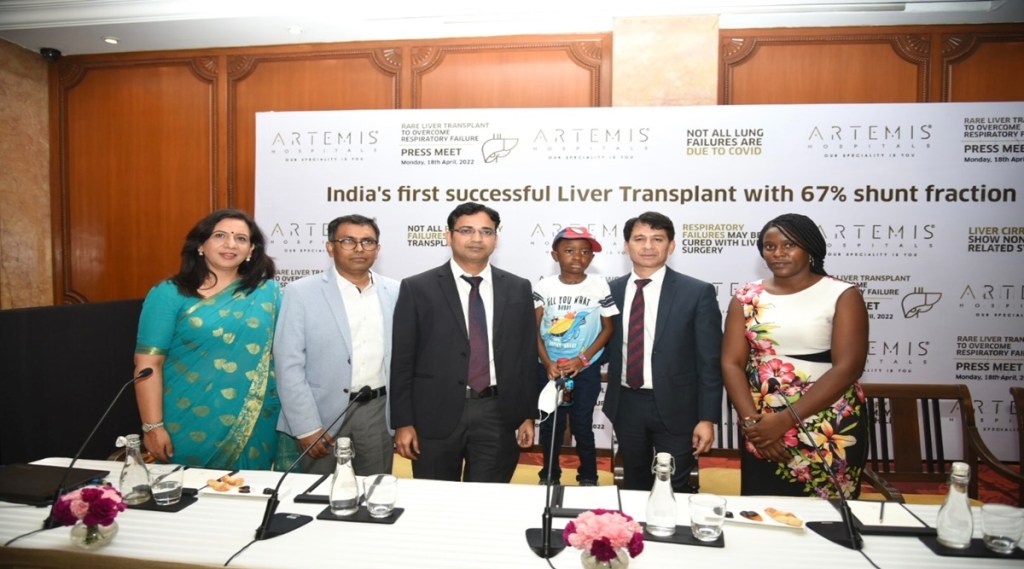 Liver, Liver transplant, liver disorder, zimbabwe, Artemis Hospital, health news, health updates,