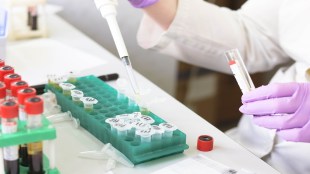 Boehringer Ingelheim, Boehringer Ingelheim Venture Fund, HKSTP, co-incubation programme, infectious diseases and immunology, health news,