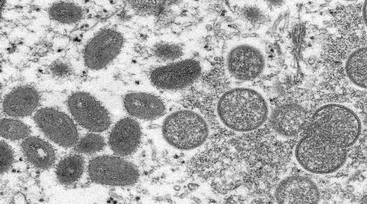 Bavarian Nordic, monkeypox vaccine, IMVANEX, monkeypox outbreak, health news, pharma news, Bavarian Nordic, monkeypox vaccine, IMVANEX, monkeypox outbreak, health news, pharma news,