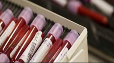 haemophilia
