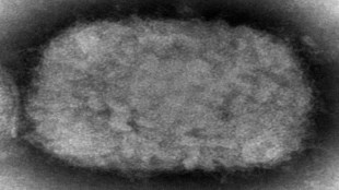 Monkey pox, monkey pox infection, WHO, small pox, health news,