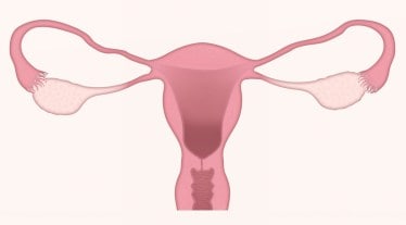 Women, women healthcare, reproductive health, health news, contraceptives,
