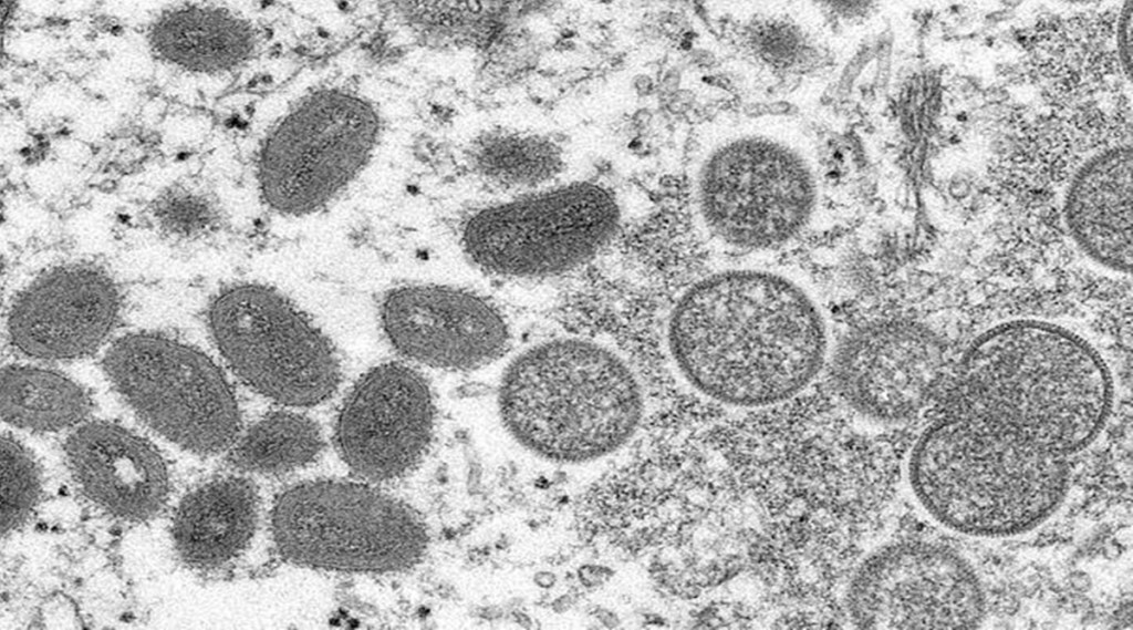 monkeypox virus, monkeypox cases,