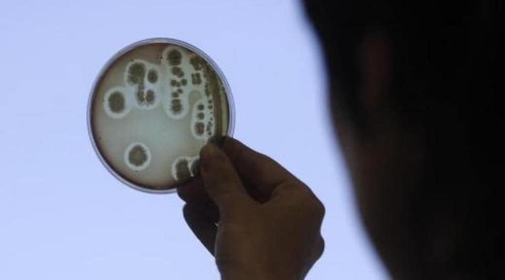 typhoid bacteria