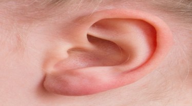 3D Printing, 3D bioprinting, ear transplant, 3DBio Therapeutics, health news,