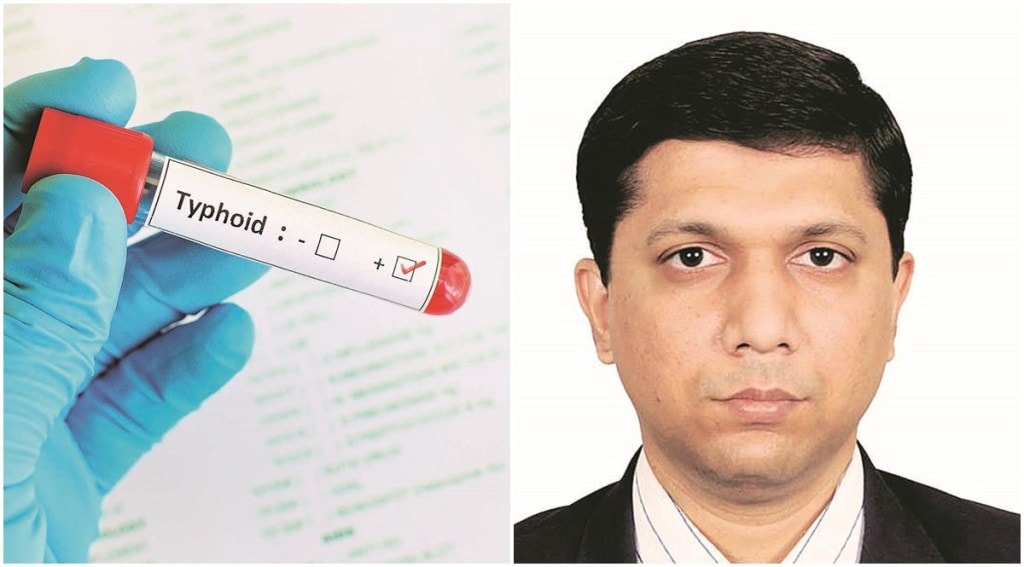 The symptoms of typhoid develop gradually after 10-20 days of exposure to the disease.