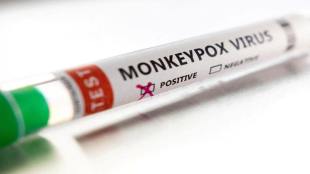 A person who returned to Kerala from abroad and was hospitalised after showing signs of monkeypox tested positive for the disease, Kerala health minister Veena George said.