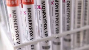 Monkeypox, Monkeypox symptoms, Monkeypox cases, Monkeypox infection, Monkeypox news, chickenpox, chickenpox symptoms, chickenpox cases, health news