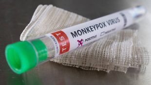 Monkey pox, monkey pox infection, WHO, small pox, health news,