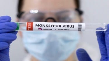 Monkeypox, Bavarian Nordic, Monkeypox outbreak, Serum Institute, Dr Reddy, Pharmaceuticals, Health news, pharma news,