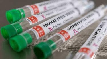 Monkey pox, monkey pox infection, Monkeypox India, WHO, small pox, health news, ICMR-NIV study,